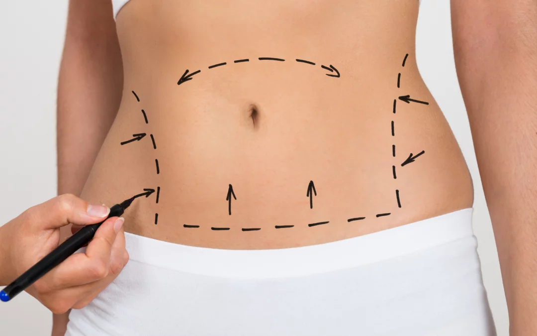 Chirurgie esthétique au Maroc _ Sunergia études